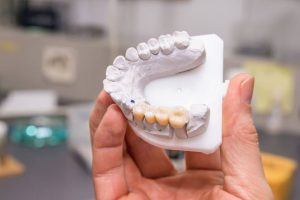 dental crowns