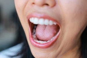close up of mouth with tooth decay