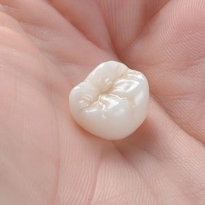 dental crown