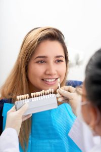 dental veneers