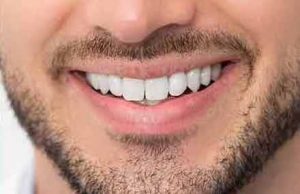 Close-up of a man's smile showcasing bright, white teeth after professional teeth whitening treatment at Sweet Hart Dental.