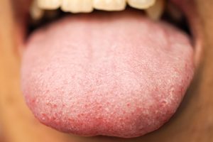 are you a supertaster